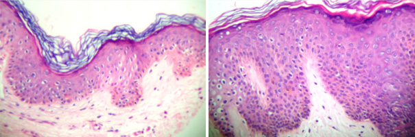 vaginal-biopsy.jpg