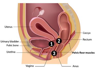 Vaginal Fistulas