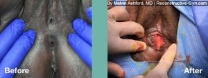 FGM Repair
